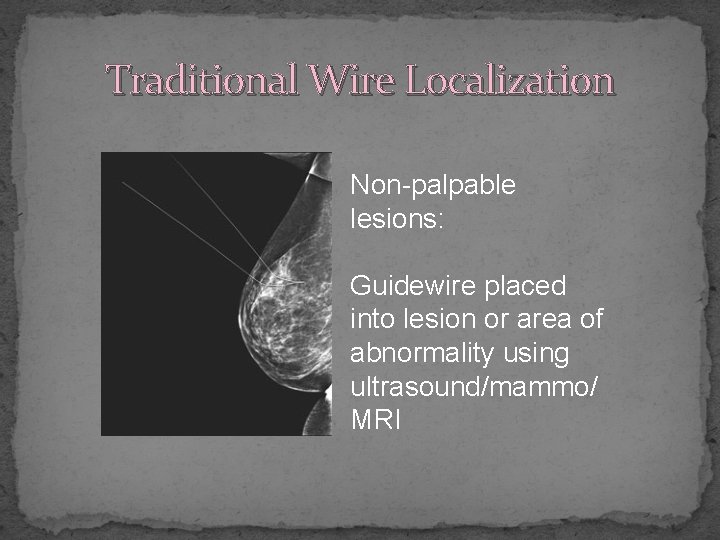 Traditional Wire Localization Non-palpable lesions: Guidewire placed into lesion or area of abnormality using