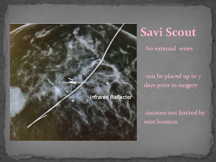 Savi Scout -No external wires -can be placed up to 7 days prior to