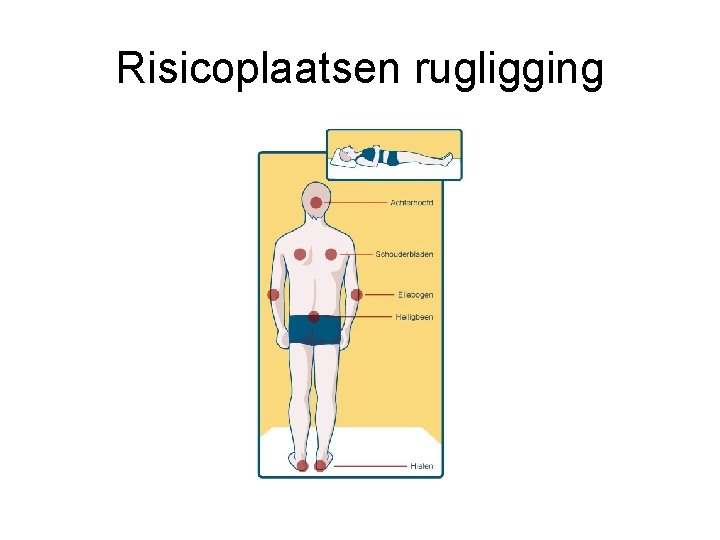 Risicoplaatsen rugligging 