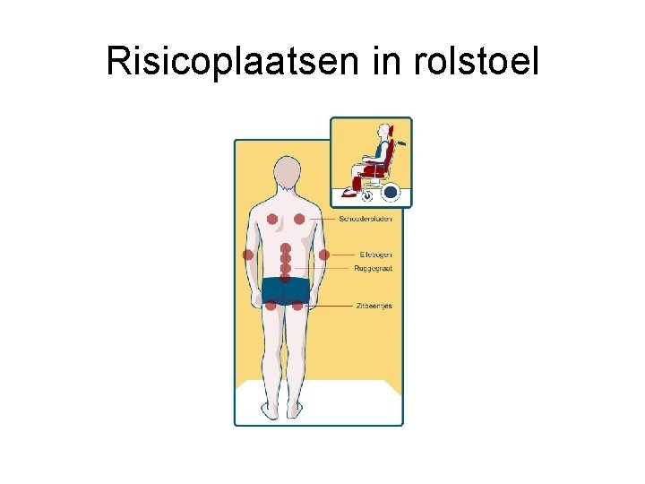 Risicoplaatsen in rolstoel 