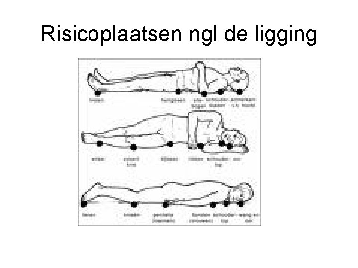 Risicoplaatsen ngl de ligging 