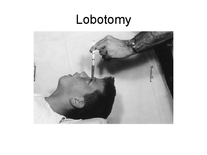 Lobotomy 