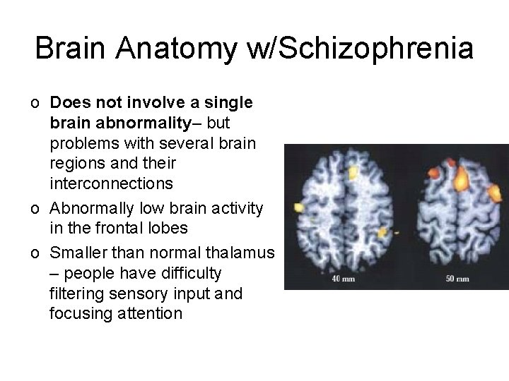 Brain Anatomy w/Schizophrenia o Does not involve a single brain abnormality– but problems with