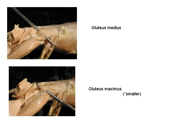 Gluteus medius Gluteus maximus (*smaller) 