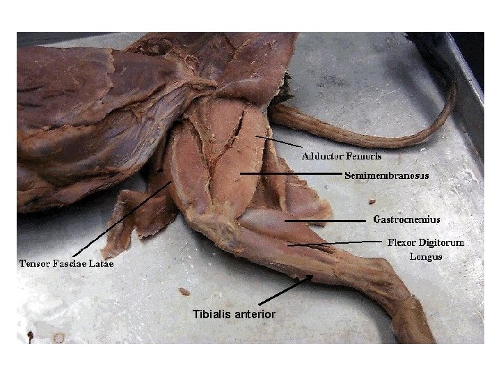 Tibialis anterior 