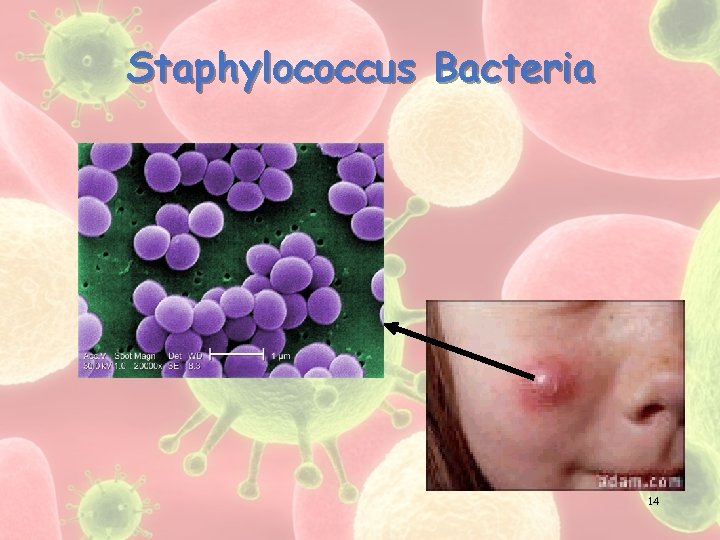 Staphylococcus Bacteria 14 