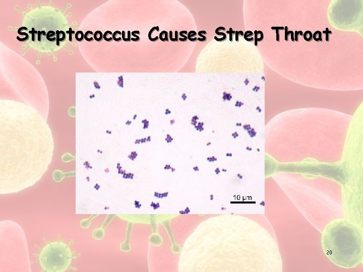 Streptococcus Causes Strep Throat 20 