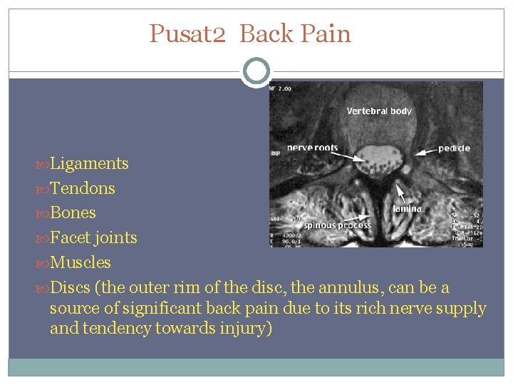 Pusat 2 Back Pain Ligaments Tendons Bones Facet joints Muscles Discs (the outer rim