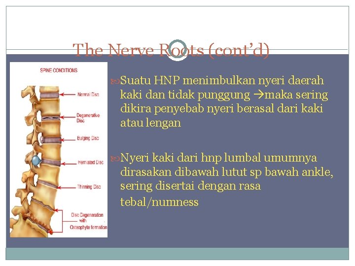 The Nerve Roots (cont’d) Suatu HNP menimbulkan nyeri daerah kaki dan tidak punggung maka