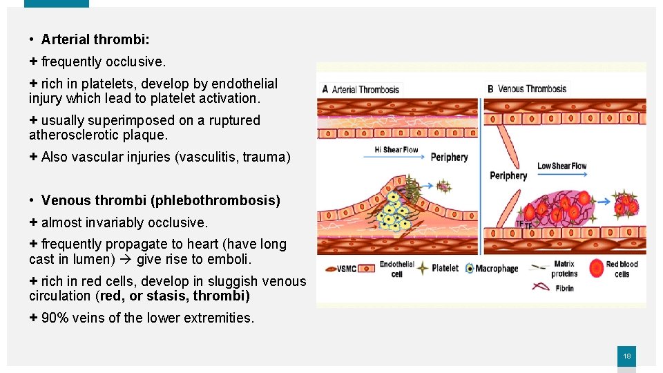  • Arterial thrombi: + frequently occlusive. + rich in platelets, develop by endothelial