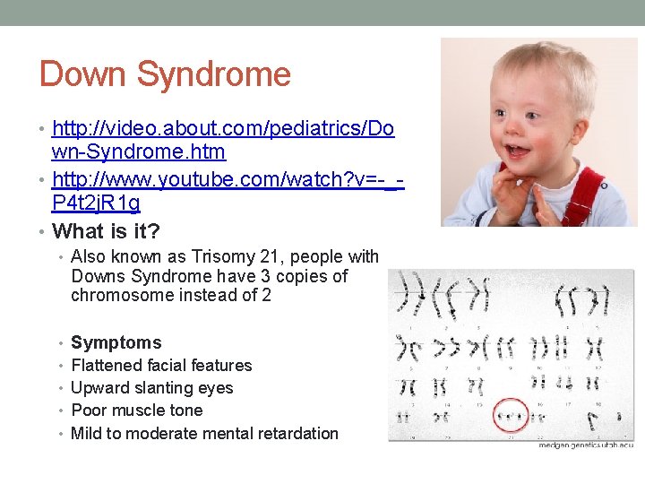 Down Syndrome • http: //video. about. com/pediatrics/Do wn-Syndrome. htm • http: //www. youtube. com/watch?