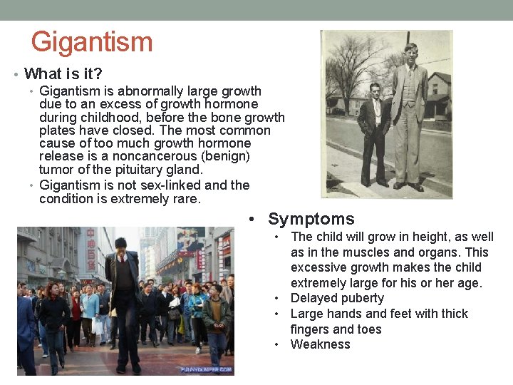 Gigantism • What is it? • Gigantism is abnormally large growth due to an