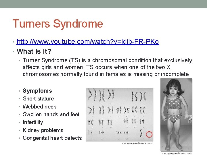 Turners Syndrome • http: //www. youtube. com/watch? v=ldjb-FR-PKo • What is it? • Turner