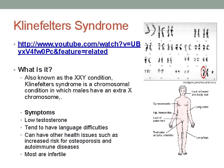 Klinefelters Syndrome • http: //www. youtube. com/watch? v=UB yx. V 4 fw 0 Pc&feature=related