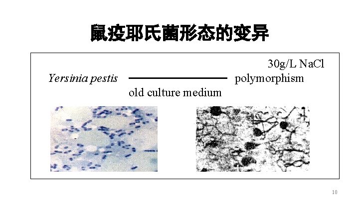 鼠疫耶氏菌形态的变异 30 g/L Na. Cl polymorphism Yersinia pestis old culture medium 10 