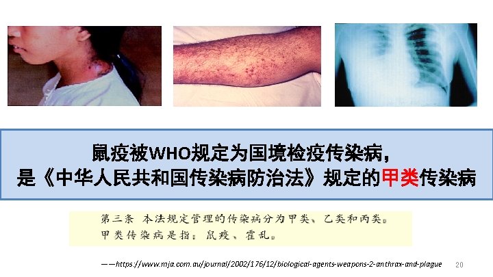 鼠疫被WHO规定为国境检疫传染病， 是《中华人民共和国传染病防治法》规定的甲类传染病 ——https: //www. mja. com. au/journal/2002/176/12/biological-agents-weapons-2 -anthrax-and-plague 20 