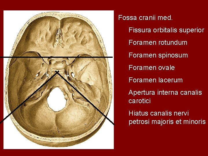 Fossa cranii med. Fissura orbitalis superior Foramen rotundum Foramen spinosum Foramen ovale Foramen lacerum