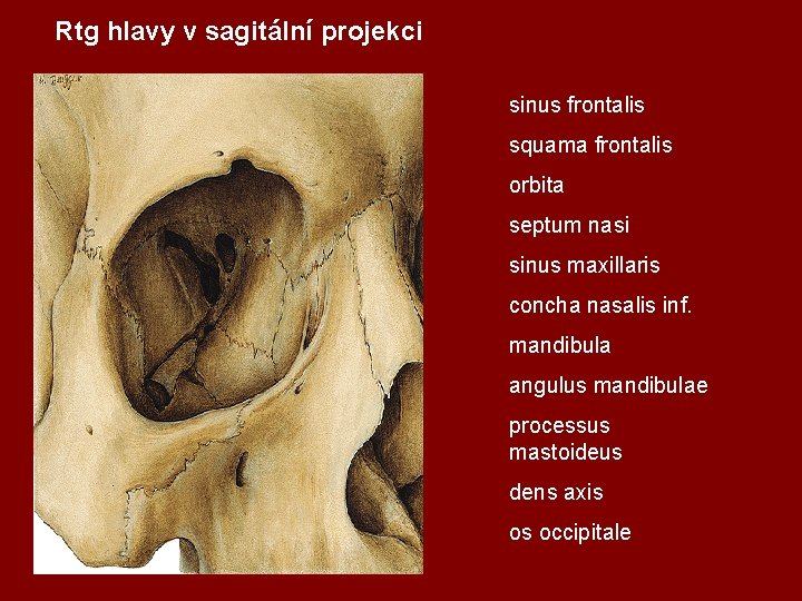 Rtg hlavy v sagitální projekci sinus frontalis squama frontalis orbita septum nasi sinus maxillaris