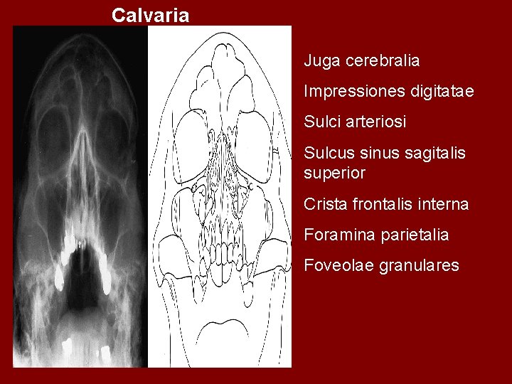 Calvaria Juga cerebralia Impressiones digitatae Sulci arteriosi Sulcus sinus sagitalis superior Crista frontalis interna