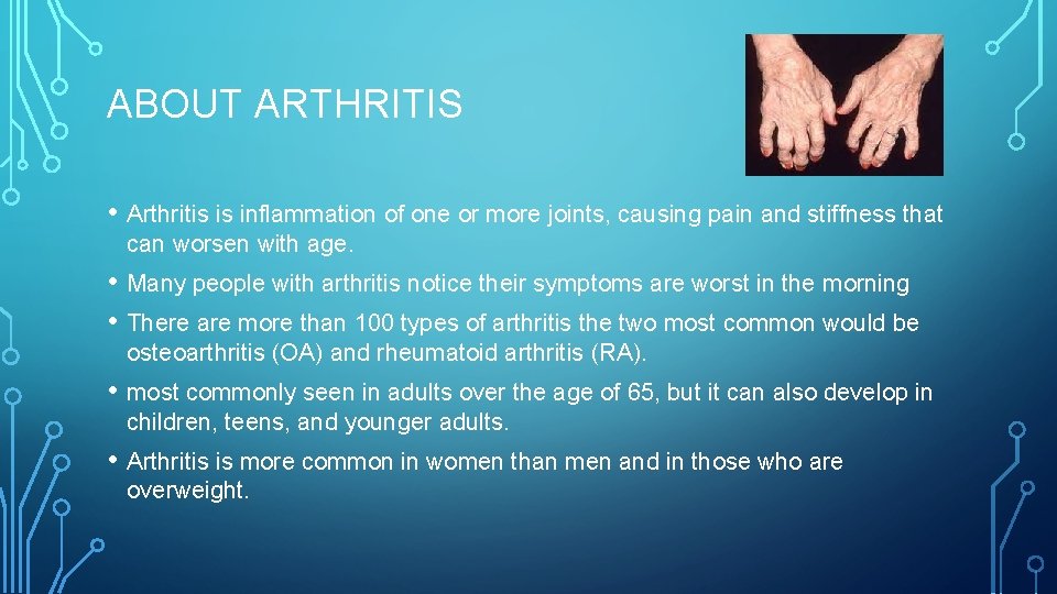 ABOUT ARTHRITIS • Arthritis is inflammation of one or more joints, causing pain and