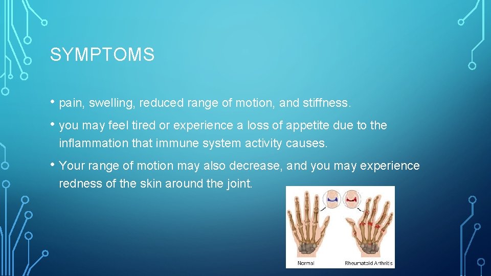 SYMPTOMS • pain, swelling, reduced range of motion, and stiffness. • you may feel