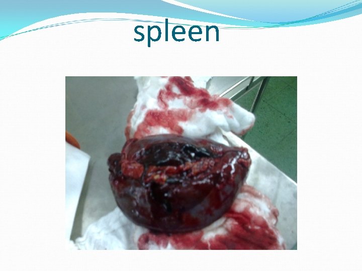 spleen 