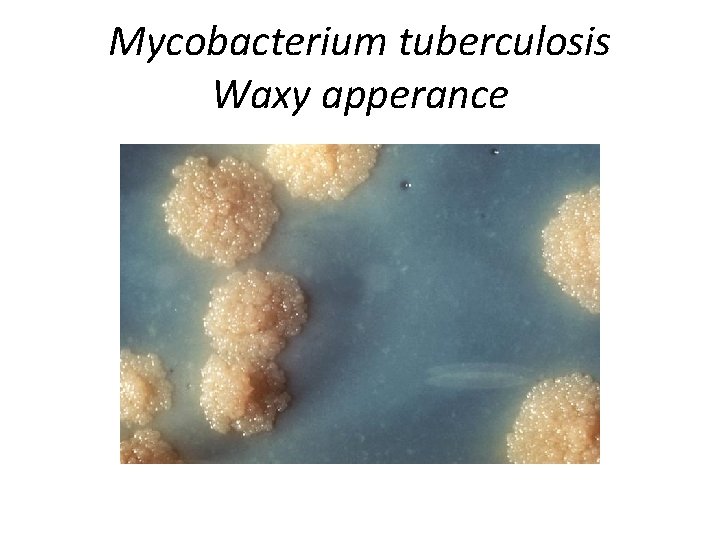 Mycobacterium tuberculosis Waxy apperance 
