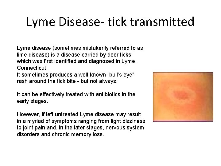 Lyme Disease- tick transmitted Lyme disease (sometimes mistakenly referred to as lime disease) is