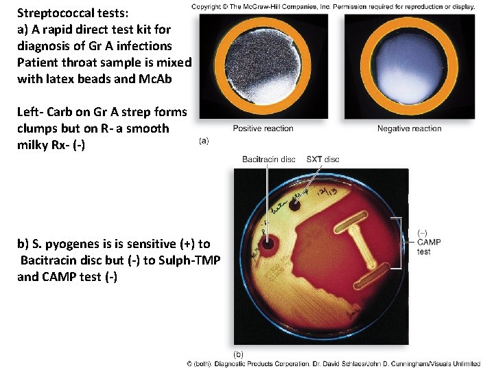 Streptococcal tests: a) A rapid direct test kit for diagnosis of Gr A infections