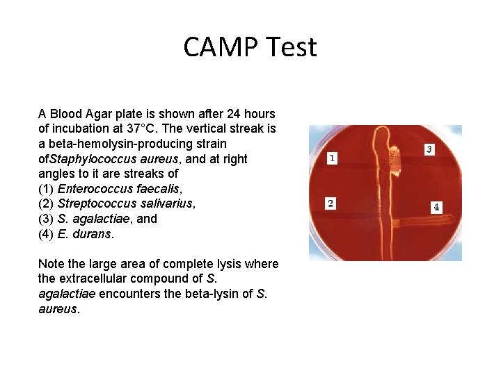 CAMP Test A Blood Agar plate is shown after 24 hours of incubation at