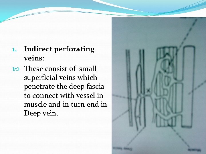 1. Indirect perforating veins: These consist of small superficial veins which penetrate the deep