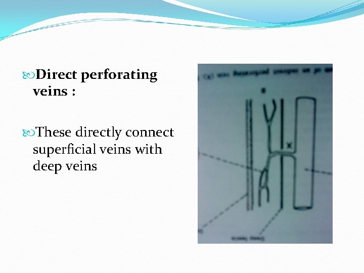  Direct perforating veins : These directly connect superficial veins with deep veins 