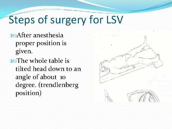 Steps of surgery for LSV After anesthesia proper position is given. The whole table