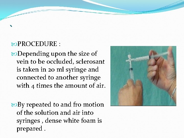 ` PROCEDURE : Depending upon the size of vein to be occluded, sclerosant is