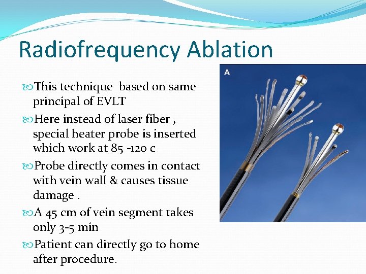 Radiofrequency Ablation This technique based on same principal of EVLT Here instead of laser