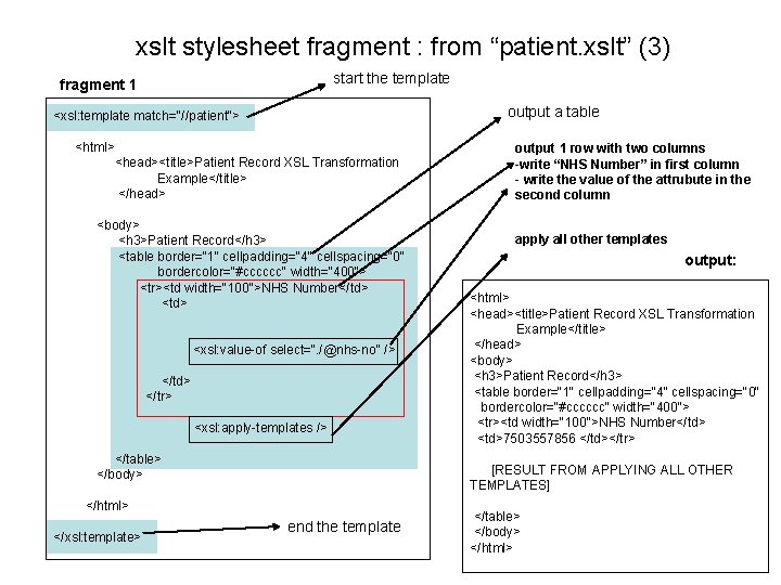 xslt stylesheet fragment : from “patient. xslt” (3) start the template fragment 1 output