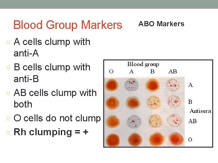 Blood Group Markers A cells clump with anti-A n B cells clump with anti-B