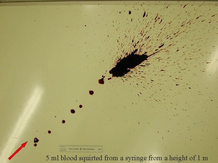 Splash 1 5 ml blood squirted from a syringe from a height of 1
