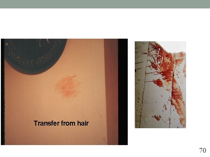 Transfer from hair 70 