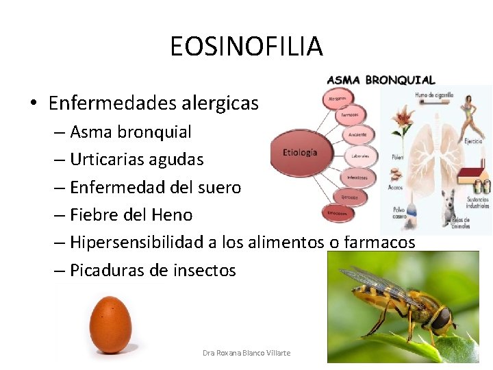 EOSINOFILIA • Enfermedades alergicas – Asma bronquial – Urticarias agudas – Enfermedad del suero
