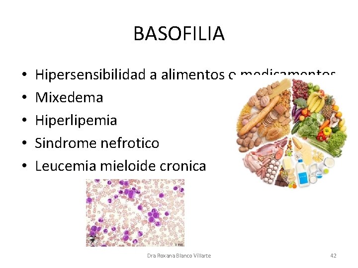 BASOFILIA • • • Hipersensibilidad a alimentos o medicamentos Mixedema Hiperlipemia Sindrome nefrotico Leucemia