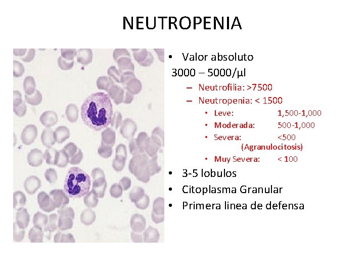 NEUTROPENIA • Valor absoluto 3000 – 5000/µl – Neutrofilia: >7500 – Neutropenia: < 1500