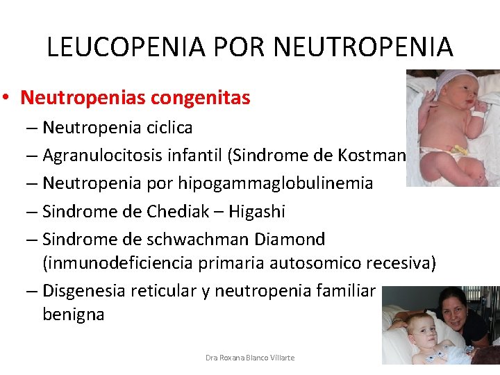 LEUCOPENIA POR NEUTROPENIA • Neutropenias congenitas – Neutropenia ciclica – Agranulocitosis infantil (Sindrome de
