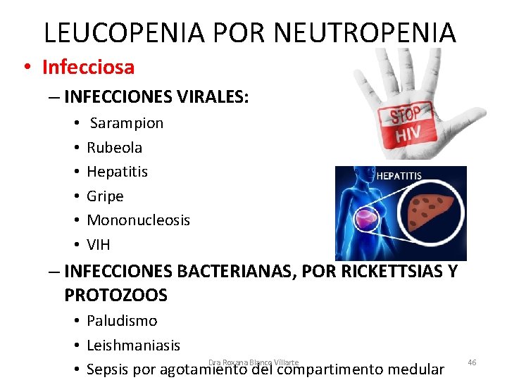 LEUCOPENIA POR NEUTROPENIA • Infecciosa – INFECCIONES VIRALES: • • • Sarampion Rubeola Hepatitis