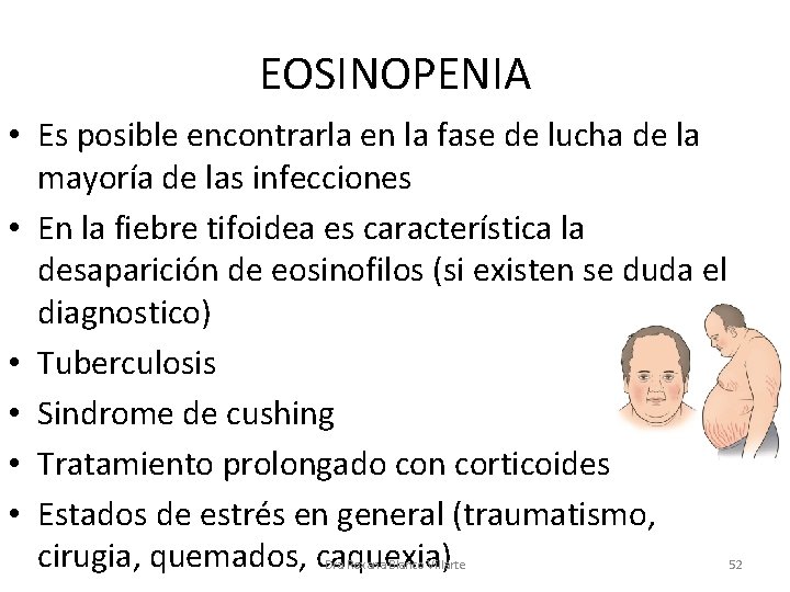 EOSINOPENIA • Es posible encontrarla en la fase de lucha de la mayoría de