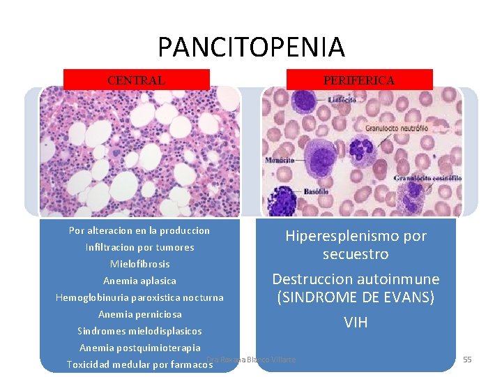 PANCITOPENIA CENTRAL Por alteracion en la produccion Infiltracion por tumores Mielofibrosis Anemia aplasica Hemoglobinuria