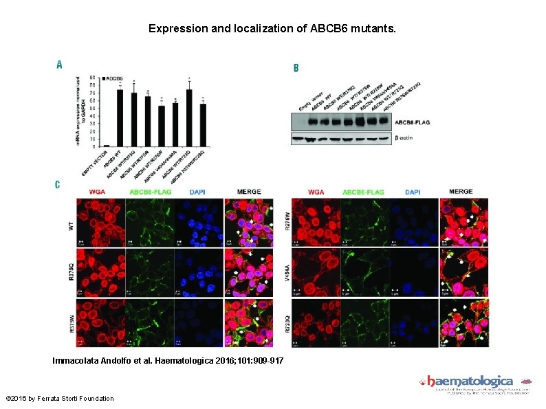 Expression and localization of ABCB 6 mutants. Immacolata Andolfo et al. Haematologica 2016; 101: