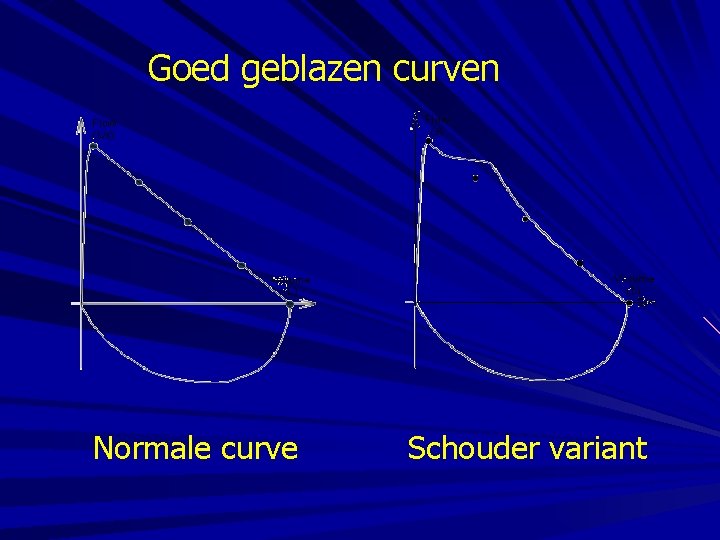 Goed geblazen curven Normale curve Schouder variant 