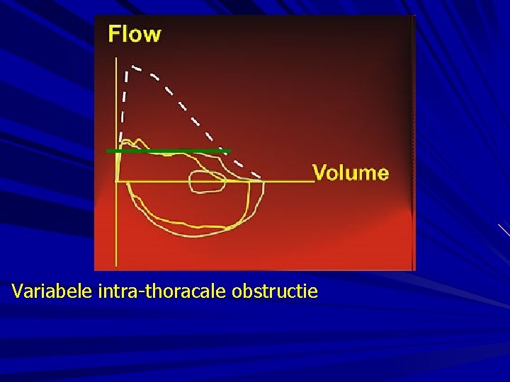 Variabele intra-thoracale obstructie 