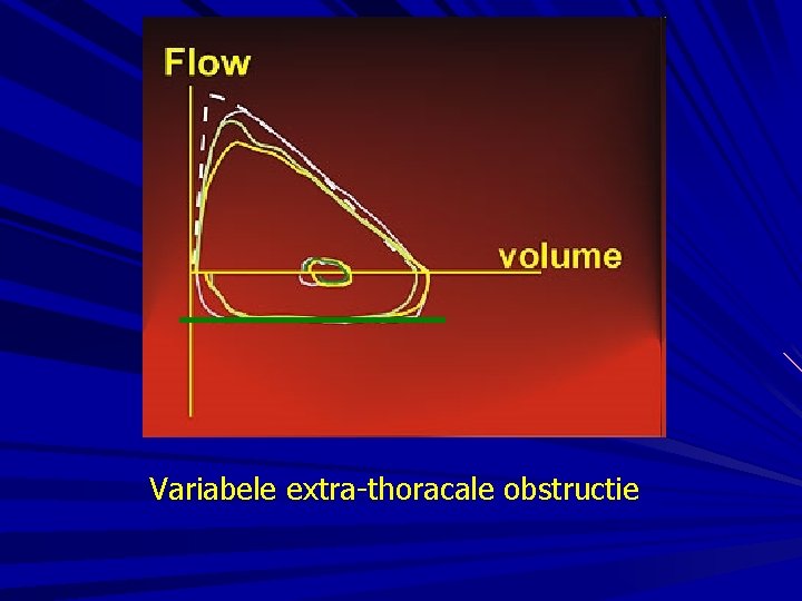 Variabele extra-thoracale obstructie 